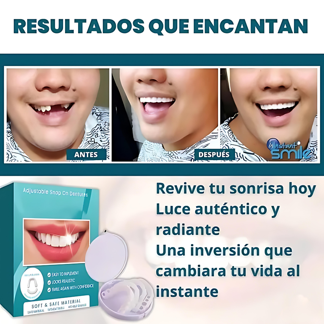 SmilePro - Carillas Dentales Ajustables De Resina