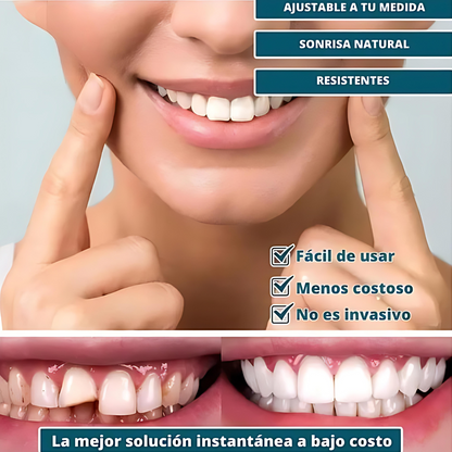 SmilePro - Carillas Dentales Ajustables De Resina