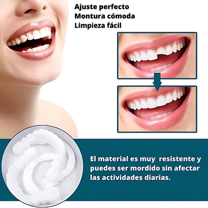 SmilePro - Carillas Dentales Ajustables De Resina