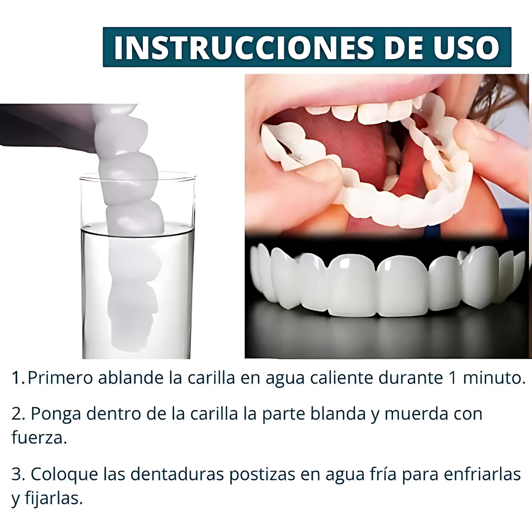 SmilePro - Carillas Dentales Ajustables De Resina