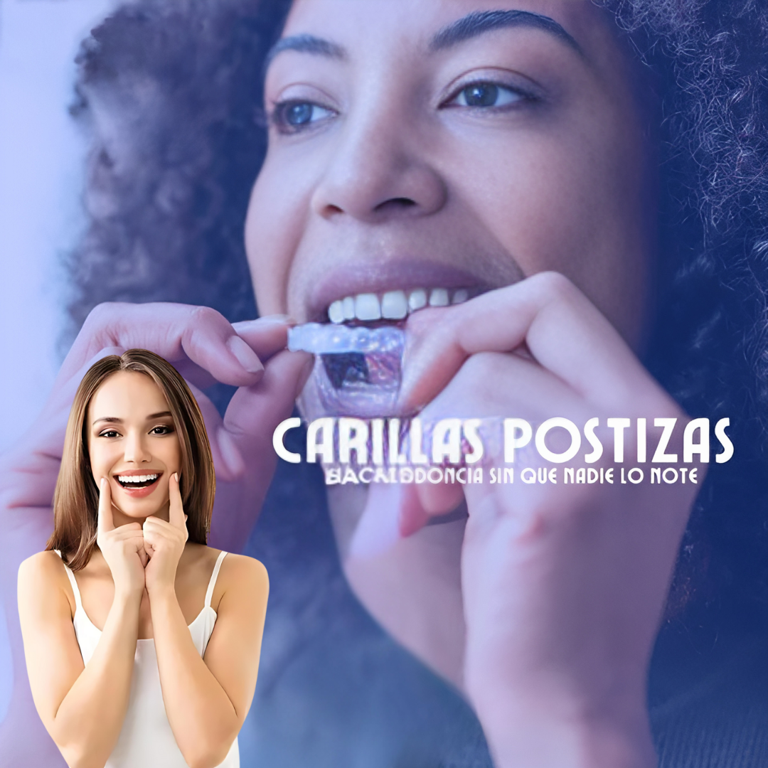 SmilePro - Carillas Dentales Ajustables De Resina