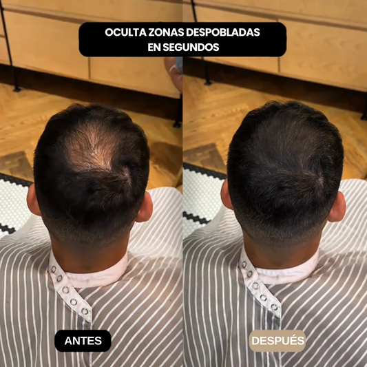 SERUM ANTICAÍDA - MAGIC ROOT