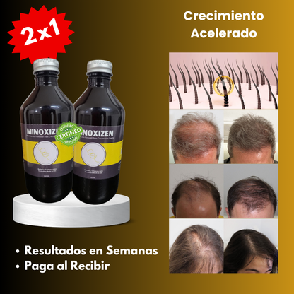 Minoxizen - Shampoo con Minoxidil, Biotina & Bergamota